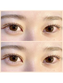 アトモス サニーテラス(Atmos sunny terrace)/奥二重　まつパ