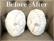 R-1ビューティーサロン 表参道/Before&After(６回)