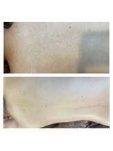 フィズ 五日市彩が丘店(FIS)/☆before/after☆都度払い