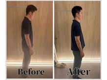 整体ラルース 中目黒(LALUZ)/20代　男性　猫背、巻き肩改善
