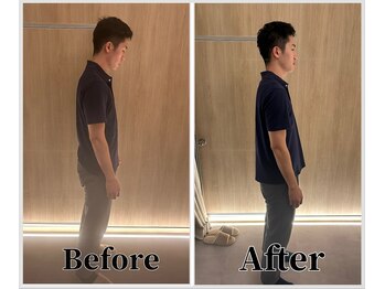 整体ラルース 中目黒(LALUZ)/20代 男性 猫背、巻き肩改善