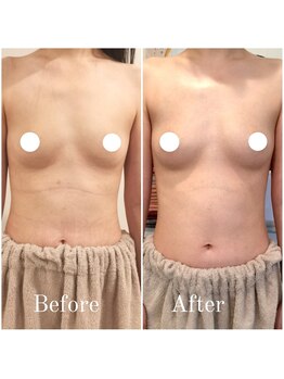 ティアラ(TIARA)/インスタ【@takara_tiara】