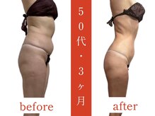 ウィズルーチェ 麻布十番店(with luce)/50代/頭の先からつま先まで