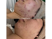 シグネット(Cygnet)の雰囲気（敏感肌ケアやニキビケアが得意！豊富な知識で改善へ導きます）