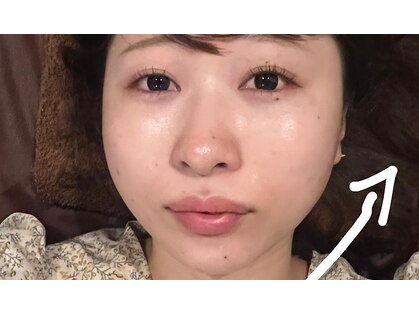 ニクス(nyx)の写真
