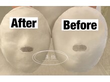 美極 トータルビューティー(美極 TOTAL BEAUTY)/恵比寿/小顔コルギ/エステ/