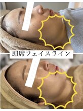 ビンナ 五反田店(Binna)/3d立体小顔矯正