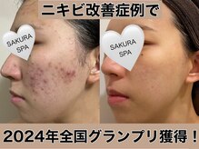 サクラ スパ(SAKURA SPA)の雰囲気（ドクターリセラ全国美肌コンテストでのグランプリ受賞実績あり）