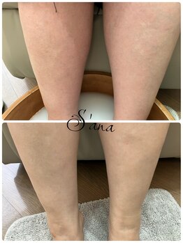 サナ 久が原 千鳥町(S’ana)/フット【スペシャルケア】