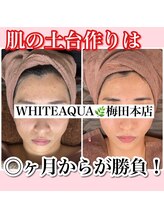 アルムダアクア 天王寺店(Aleumda AQUA)/ハーブピーリング/大阪/天王寺