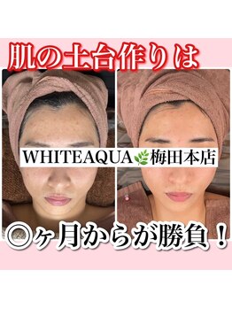 アルムダアクア 天王寺店(Aleumda AQUA)/ハーブピーリング/大阪/天王寺