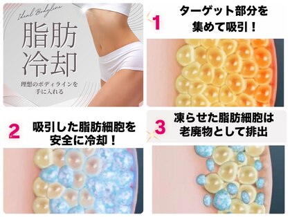 ワンミュ(One.miu)の写真