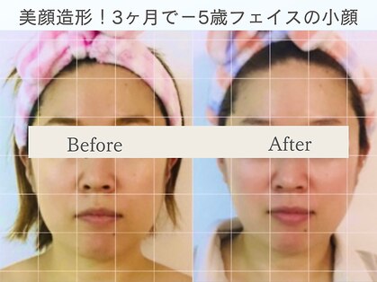 小顔コルギアンドフェイシャルサロン ジュエル(JEWEL)の写真