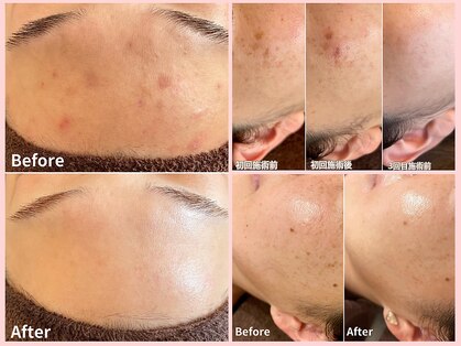 ジン フォー ユアビューティー(JIN for your beauty)の写真