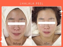 シロカネ 光の森店(SHIROKANE)/ララピール☆