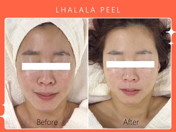 シロカネ 光の森店(SHIROKANE)/ララピール☆