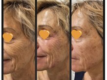 ティーボックスボーテ(TBOX beaute)/