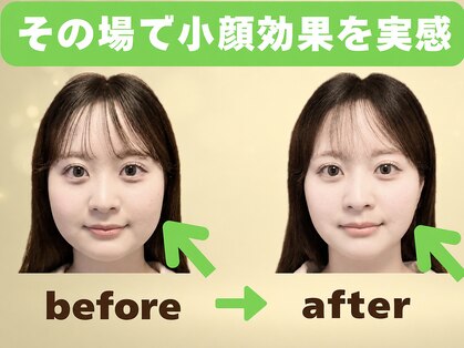 カラダリセット 上本町の写真
