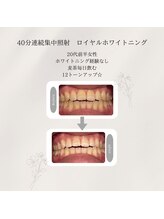 プラスビーセルフ(+b self)/ホワイトニングビフォーアフター