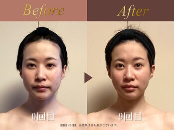 オーシャン(Ocean)/全身美容矯正120分/週1回×10回