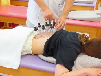 接骨院いなば/《吸引・カッピング》