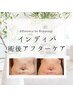 【術後アフターケア】二の腕インディバ60分☆　¥13200