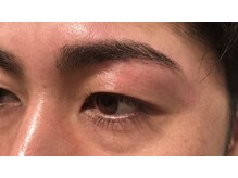 ビューブルー 亀戸錦糸町(VIEW BLUE)/【眉毛WAX脱毛】i.blue