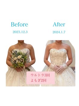 トータルケアーサロン アクア 時津(AQUA)/ブライダルケアもお任せ下さい！