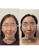 ハナン(Hanan)/オススメのフェイシャル