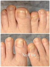 ネイルユー(Nail Yu)/フットケア
