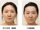 ビューティーセラピーマジック 自由が丘店(Beauty Therapy Magic)の写真