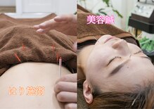 楽する鍼灸 整骨院 南福岡院