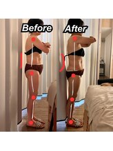 プラスイチド/60代・姿勢矯正