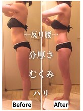 リエンシン(Riensin)/【レッドショット】頑固なお腹も