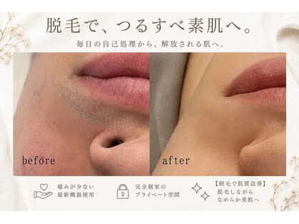 サロン ド ボーテ ミュゲの写真