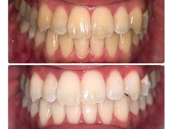 ゴールドプラス 小牧店(GOLD PLUS)/ BeforeAfter