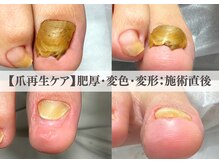 ラネイル(Ra Nail)の雰囲気（特殊技術の爪再生ケアで長年の爪悩みとさよなら!!爪育成サポート）