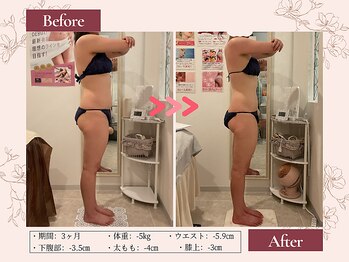 リムサロン(RIMSALON)/