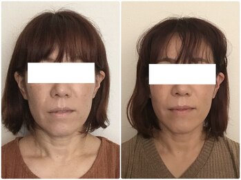 美容整体 ウェリナ 蟹江院/小顔矯正/骨盤矯正/痩身整体