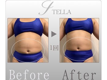 ステラ(STELLA)/上半身プレミアムの効果
