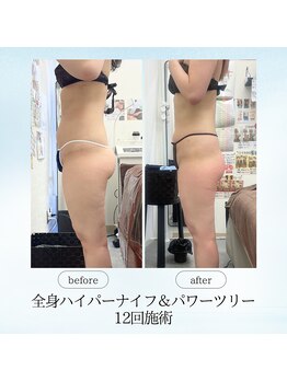 エスプレッソ(espresso,)/【全身ツリー】でバランス良く