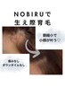 【生え際】NOBIRUでおでこ小顔コース ¥9,900→¥7,700 40分