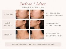 【たるみケア・シミケア・毛穴】エイジングケアAreum(アルム)戸塚の雰囲気(【肌育でツヤ肌】大人の肌育でたるみケア・シミケア・毛穴ケア◎)