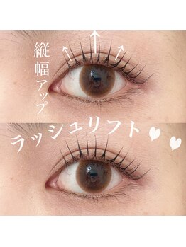 ラン(RAN)/ラッシュリフト