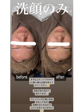 ポレ(pole)/酵素洗顔で1～２層角質整理☆