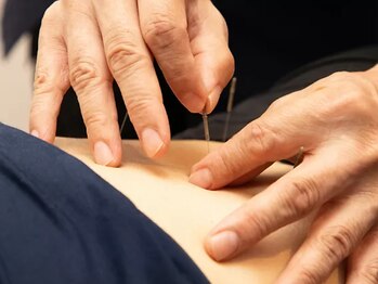 くるみ堂 祖師谷大蔵院の写真/人気の美容鍼★マッサージで改善できない慢性的な不調&疲れに！丁寧な説明で初心者にも◎全身整体+鍼¥6500~