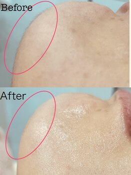 プチ プロムナード(Petit Promenade)/美肌フェイスワックス