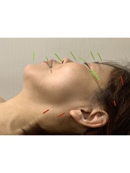 眼精疲労を解消したい