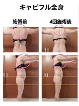 イスタナ ロゼ/キャビフル全身