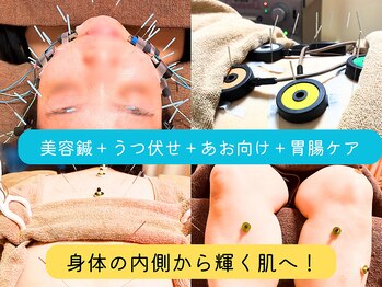 仁接骨院 じん鍼灸治療院/身体の内側から輝く肌へ!☆